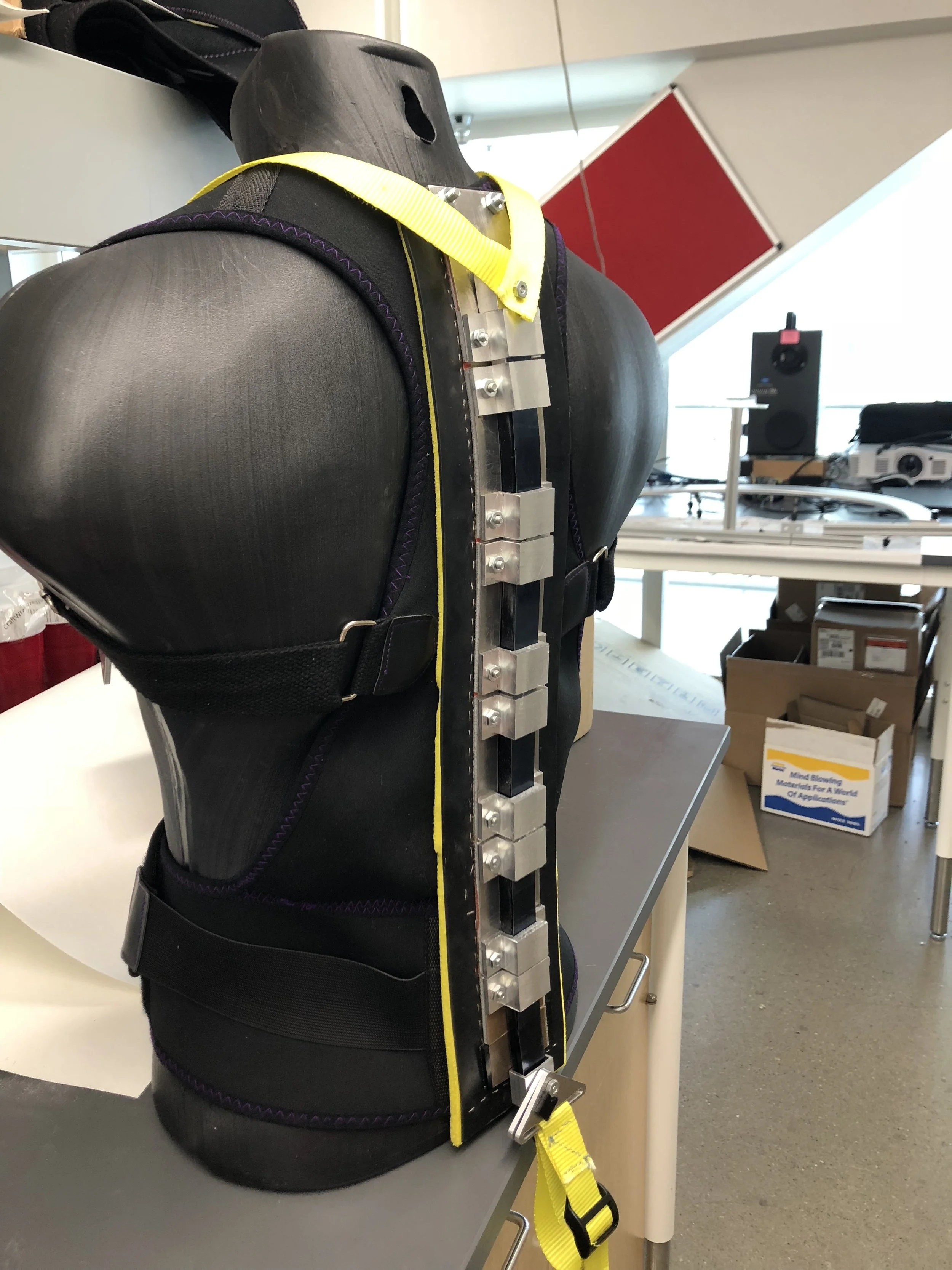 Spine Brace Customization for ALS Patients