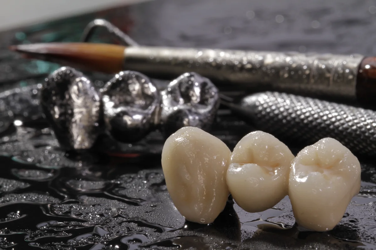 dental-lab-pointe-claire-metal-based.jpg
