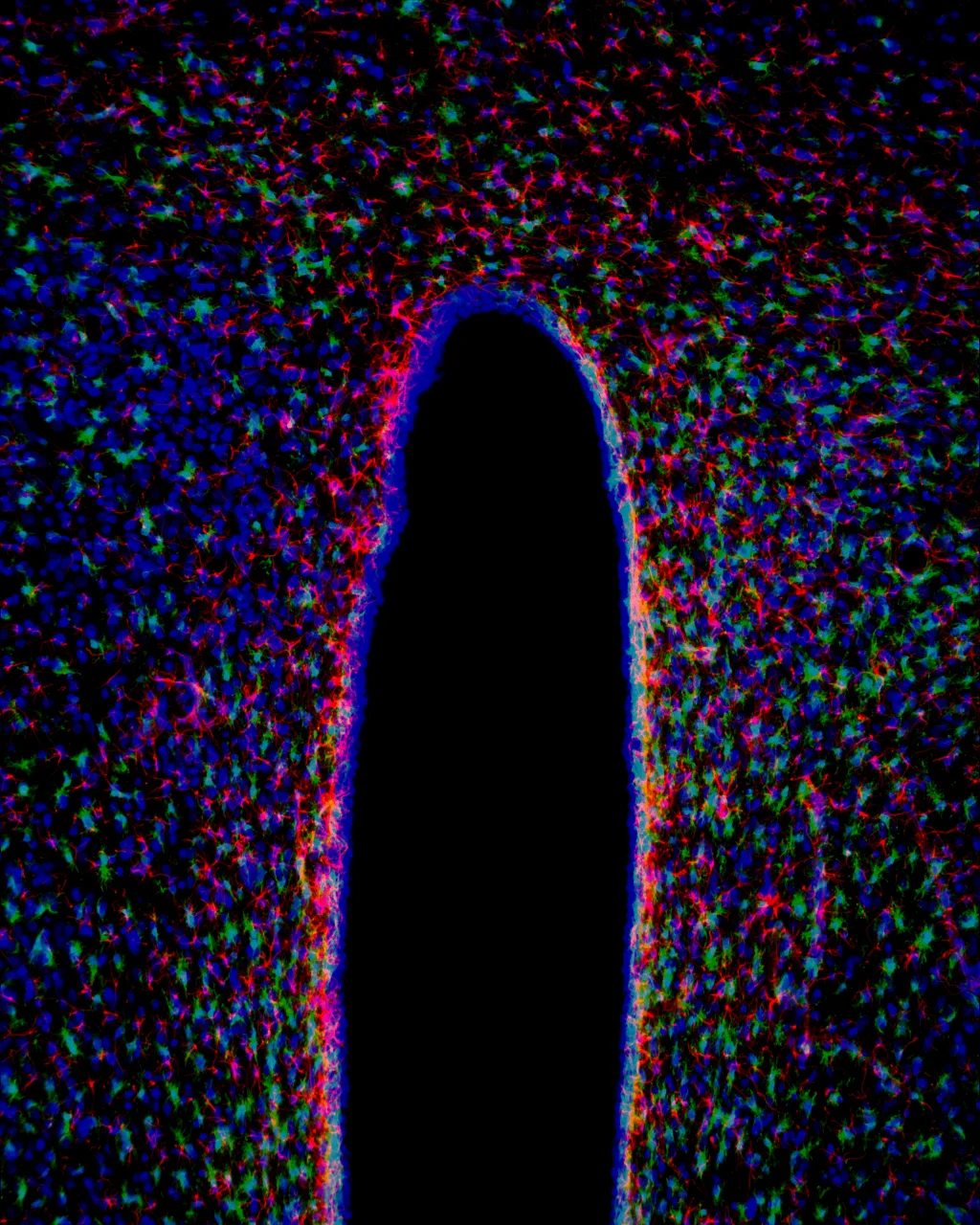 the eye DAPI.jpg