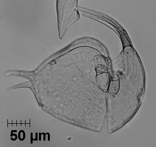 Sedimentary remains of Bosmina. Remains of the small-bodied aquatic organism Bosmina are very common in lake sediments and one of the most frequent zooplankton remains found. Bosmina live in the open-water area of lakes where they consume algae. Studies indicate Bosmina populations often increase relative to other zooplankton when lakes experience stressors, such as pollution, or other environmental changes such as the indirect effects of climate change. Pictured here is a headshield (right) and carapace (left) of Bosmina magnified at 400x.