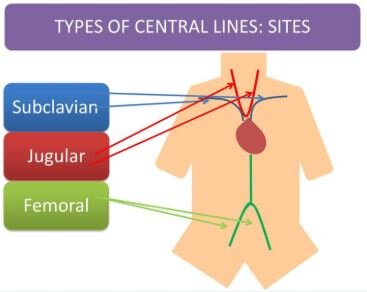 Central Lines: Tips You Can't Miss — Kwak Talk
