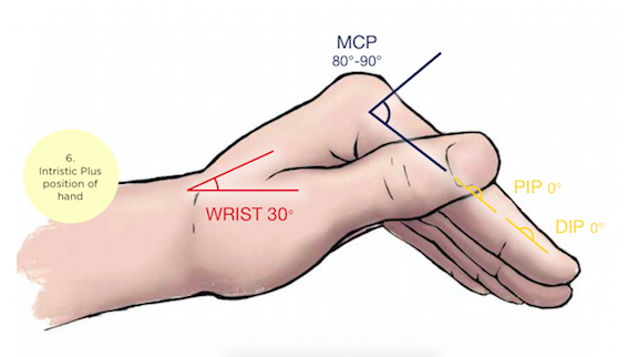 Simplifying Intrinsic Plus And Minus Hand Positions – NTBA