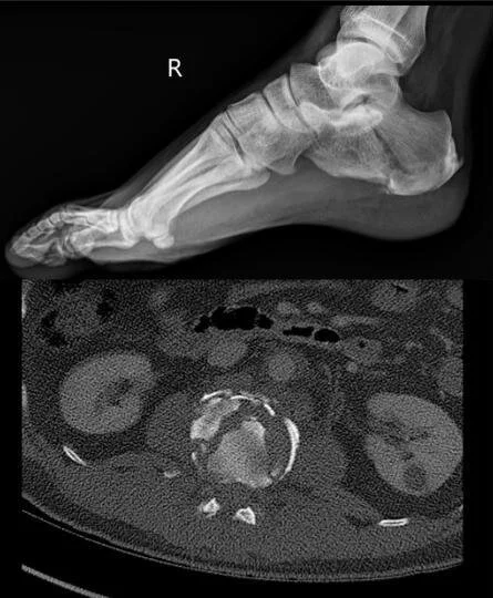 Ortho/Trauma Case: Jumper - Fall from Height