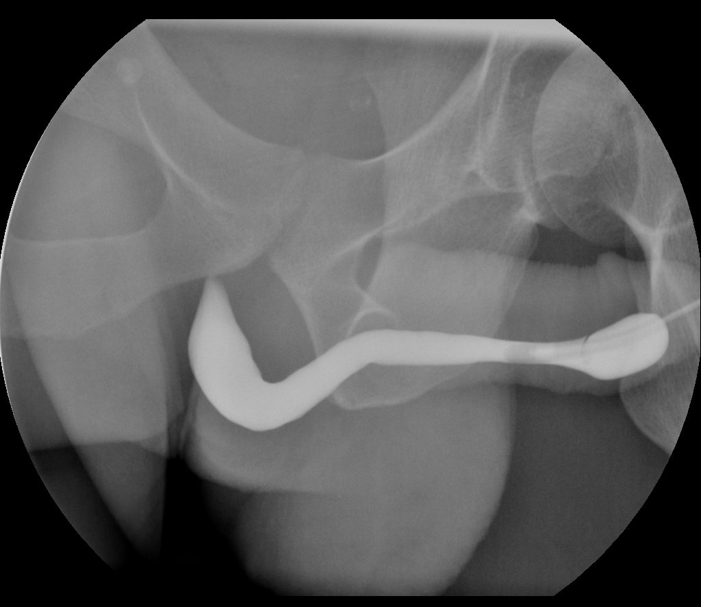 Pelvic Fractures — Kwak Talk