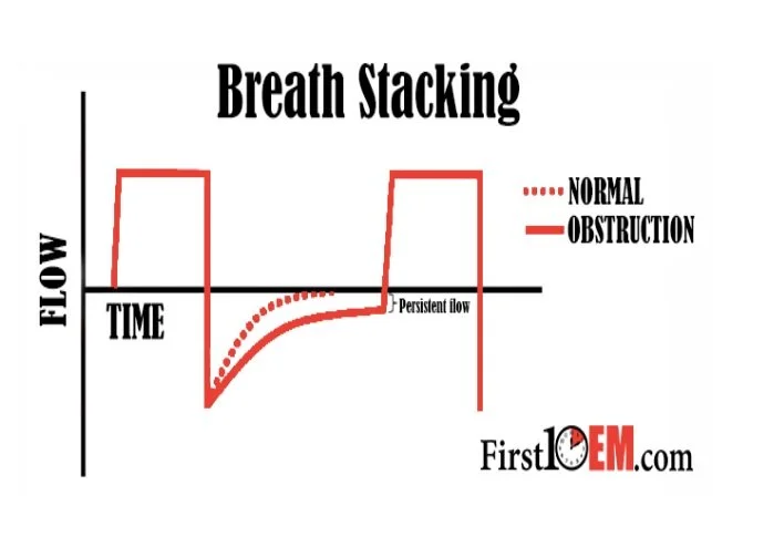 “It’s Time to Vent”