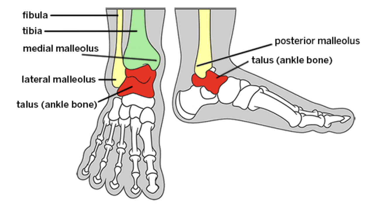 ANKLE FRACTURES: A Joint Effort Gone Wrong