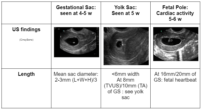 Intramyometrial gestation: A rare localization of ectopic pregnancy