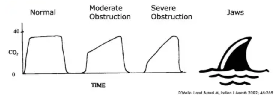 Procedural Sedation — Kwak Talk