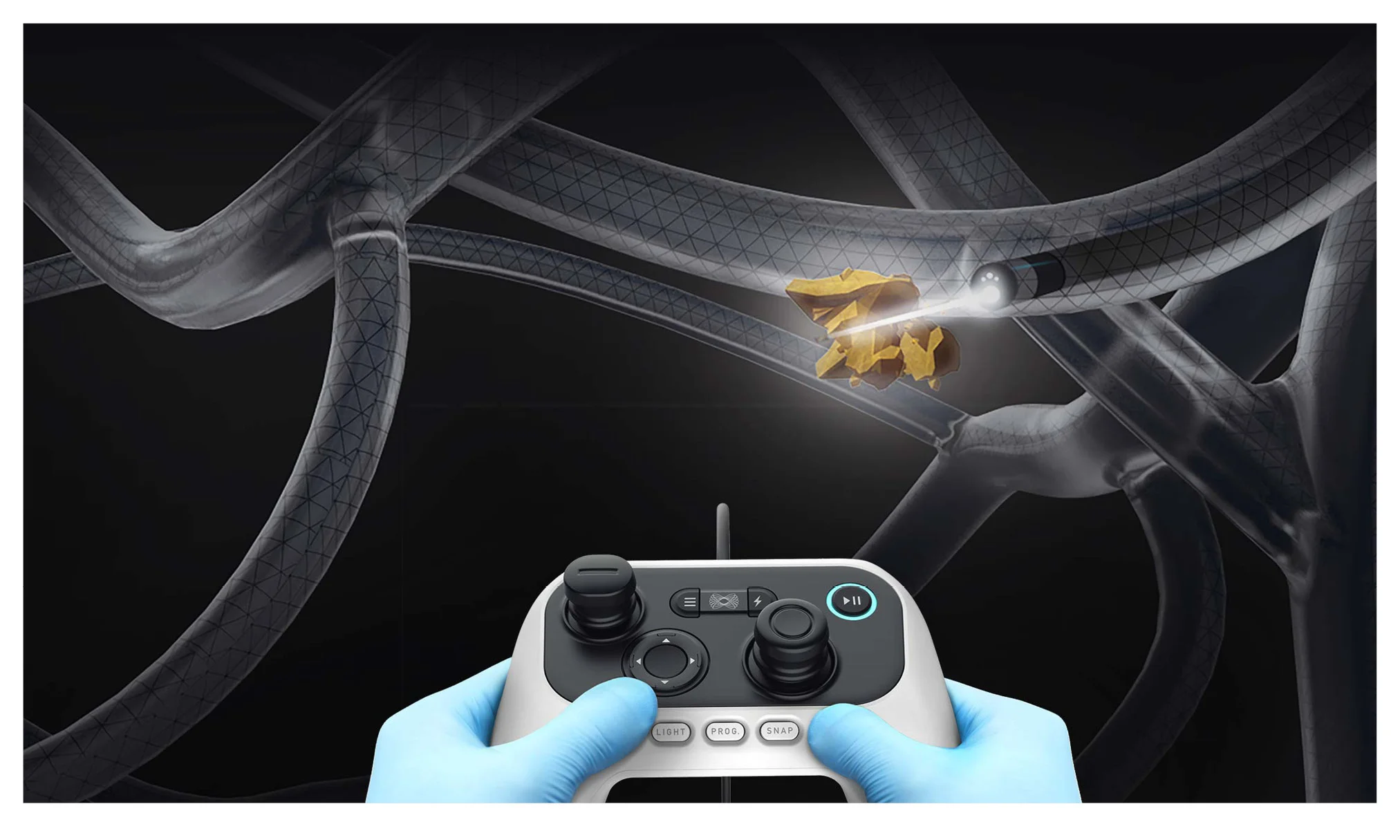 auris_controller_website2.jpg