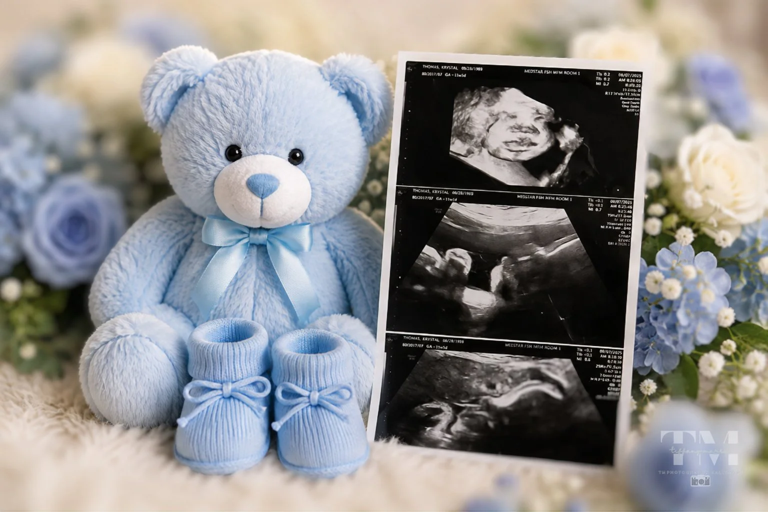 Ultrasound 1-TMPB.jpg