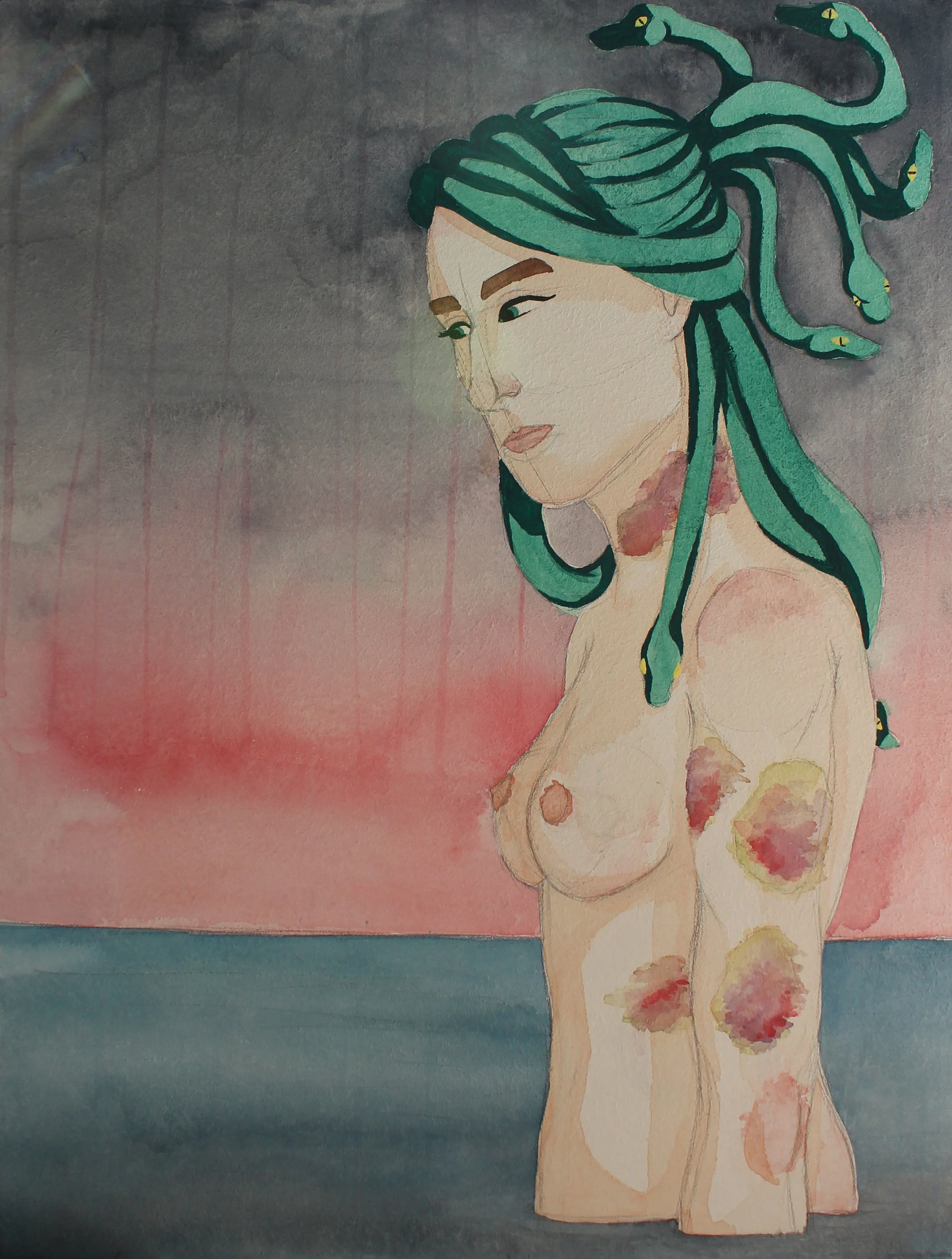 Medusa