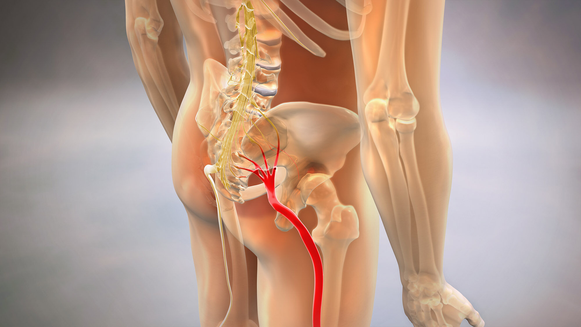 Sciatica Relief - New Light Physical Therapy and Wellness Center