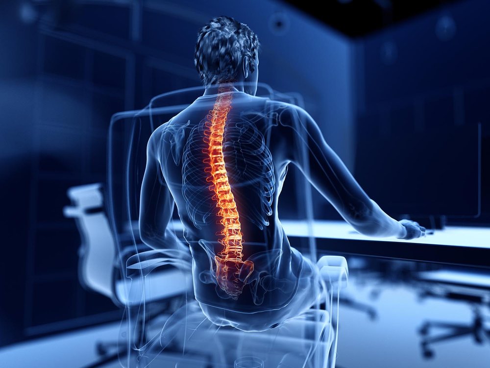 Spinal Stenosis is a common cause of low back pain and sciatica - Capitol  Pain Institute