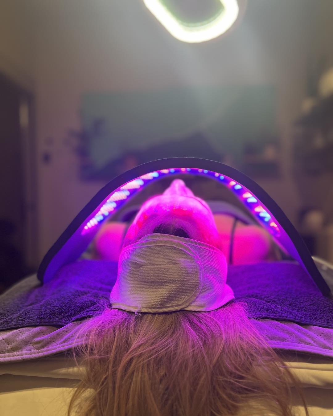 After a Procell treatment, harnessing the power of Celluma light therapy enhances and accelerates the skin's rejuvenation process. 

Celluma light promotes collagen production, reduces inflammation, and improves overall skin tone and texture. 

Exper