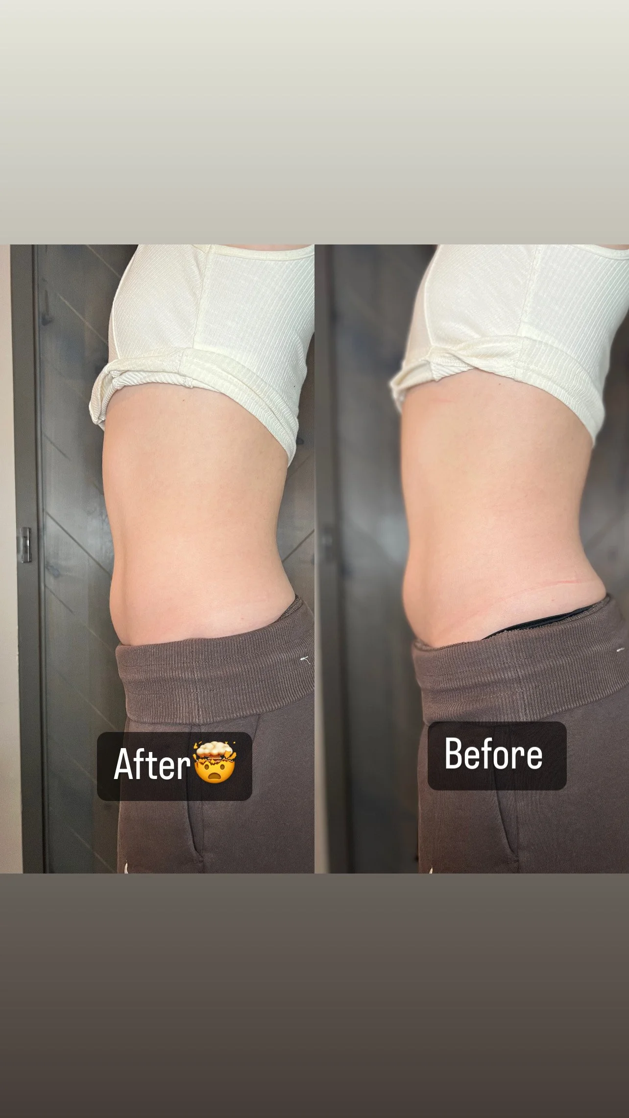The Celluma Contour