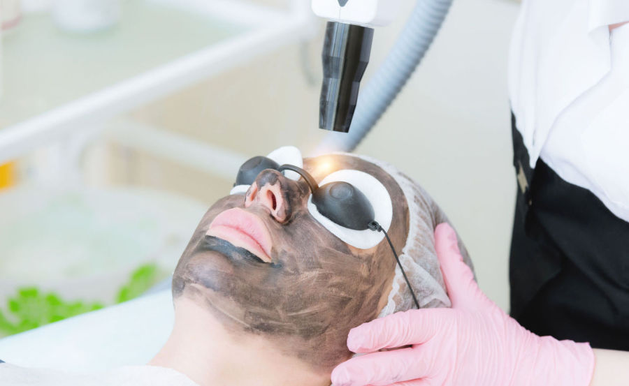 carbonlaserfacial.jpg