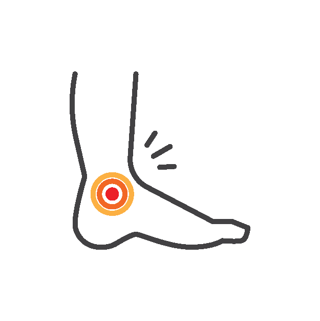 Ankle injuries
