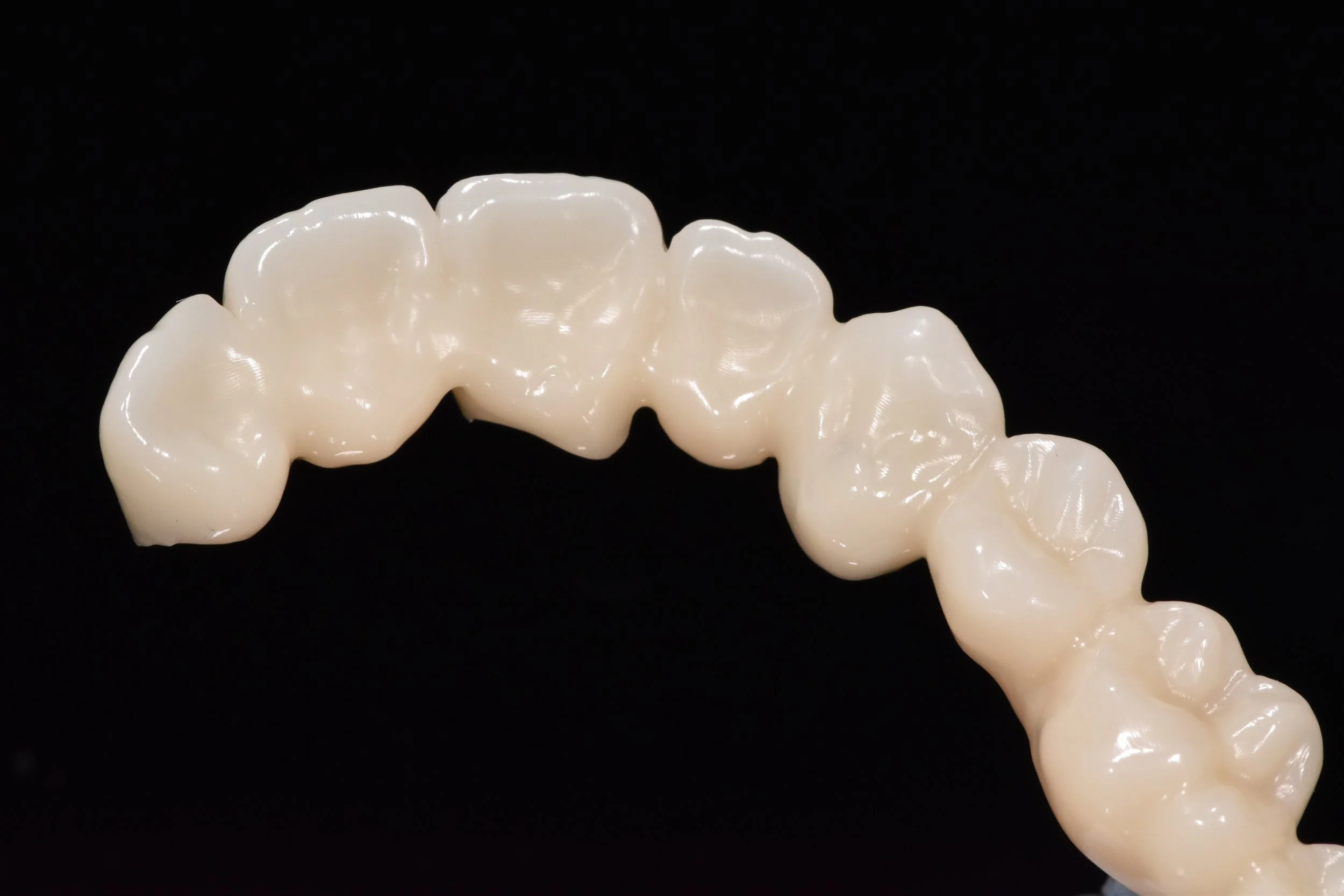 Zahnbrücke aus Keramik, schwarzer Hintergrund