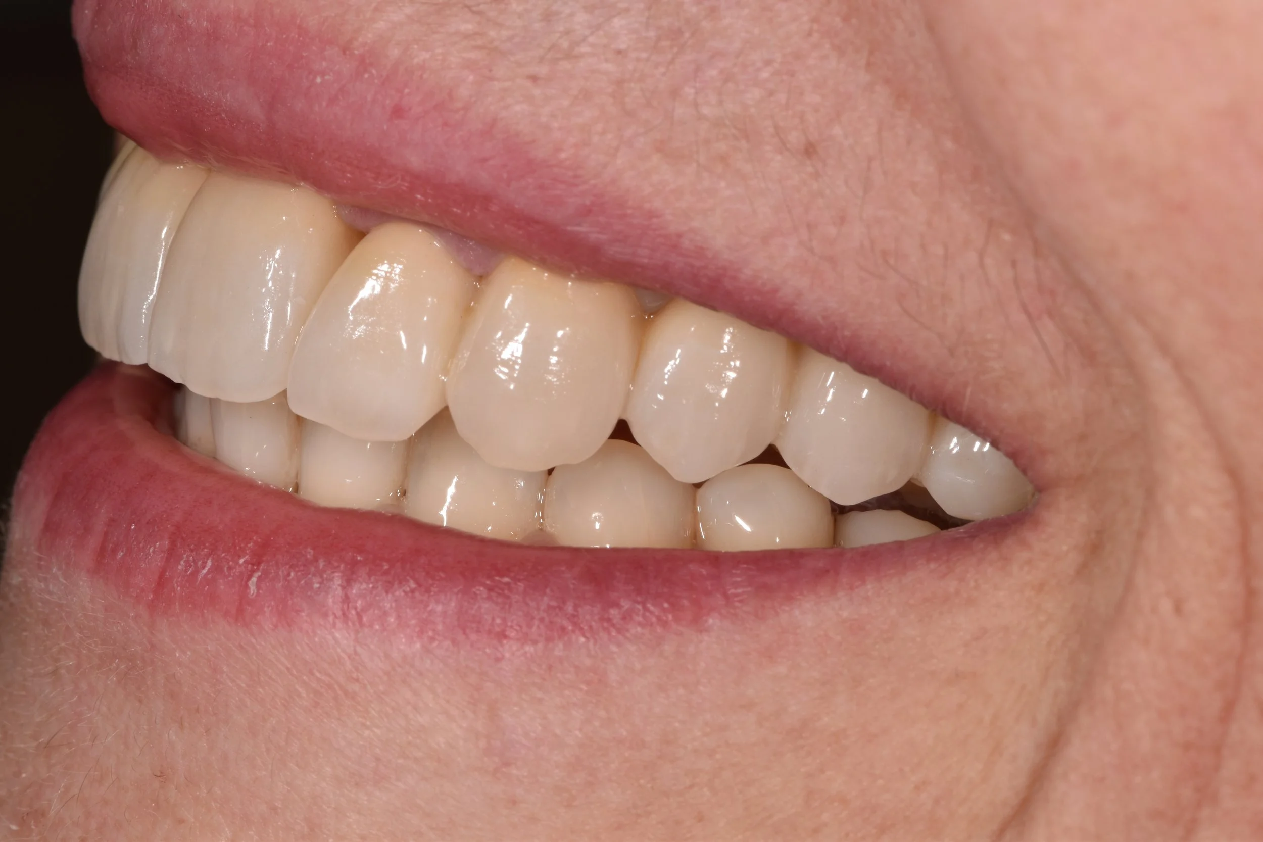 Nahaufnahme von menschlichen Zähnen beim Lächeln.