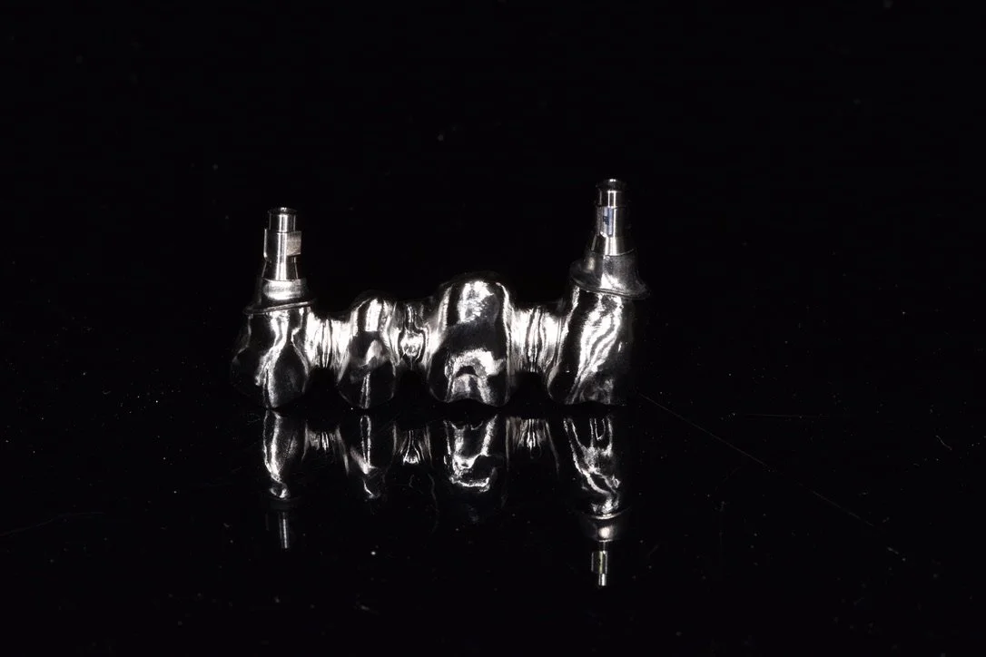 Metallisches Zahnimplantat auf dunklem Hintergrund.