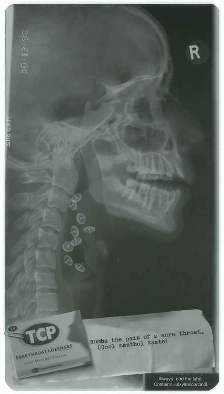 TCP X-ray.jpg