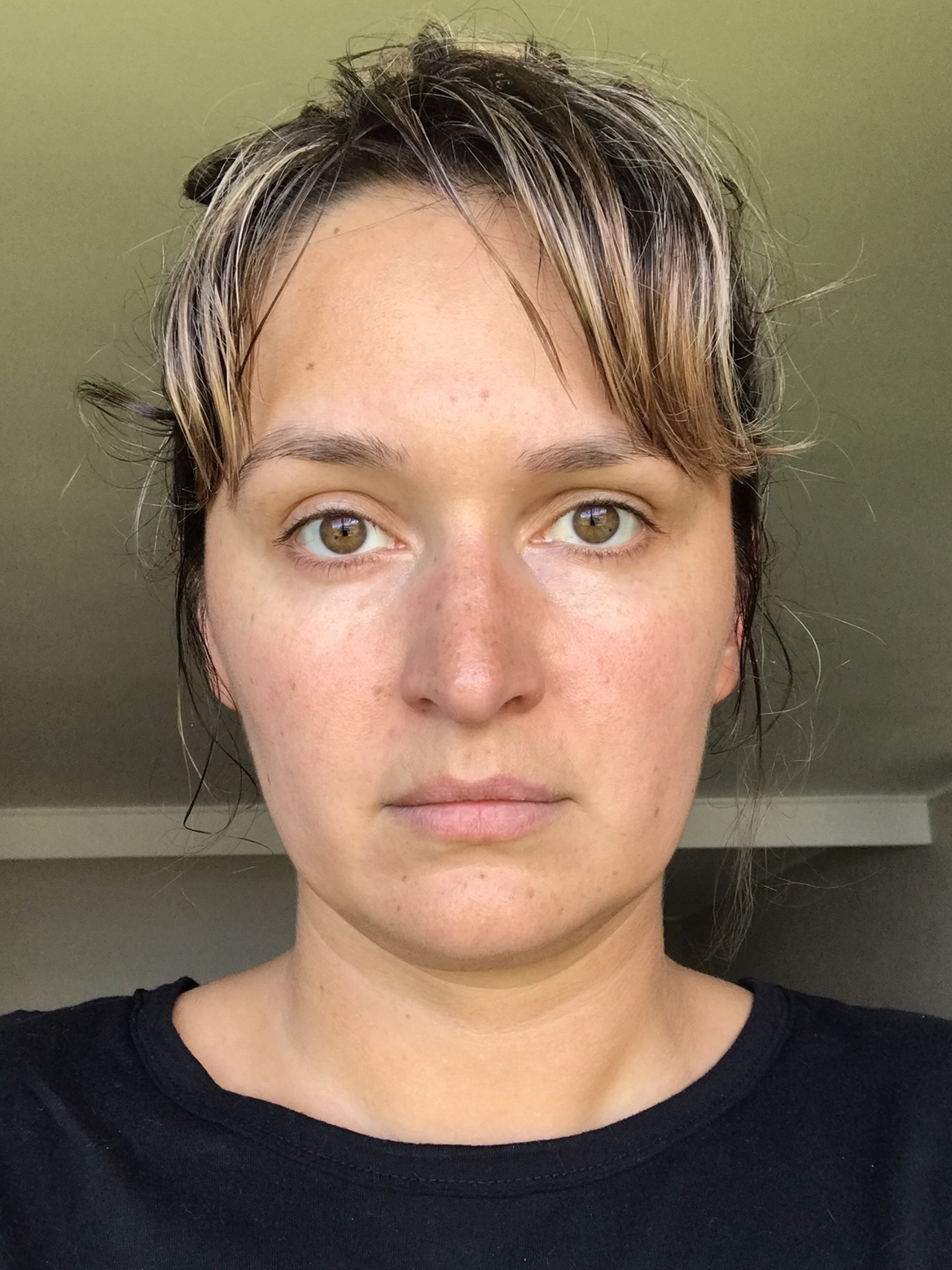 28 September 2018 : My skin felt dry, flakey and rough. Redness was also an issue.