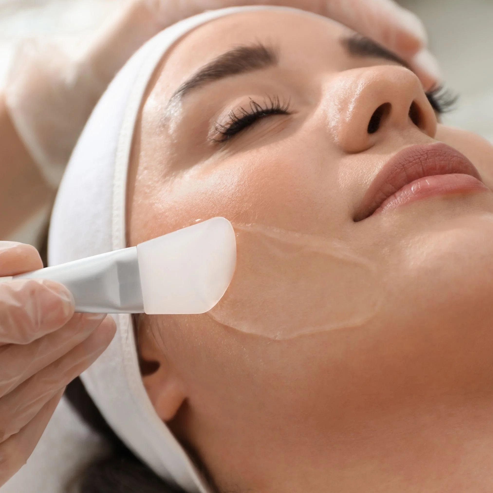 Chemical Peels at Venustas Immortalis Med Spa in Dubuque, Iowa