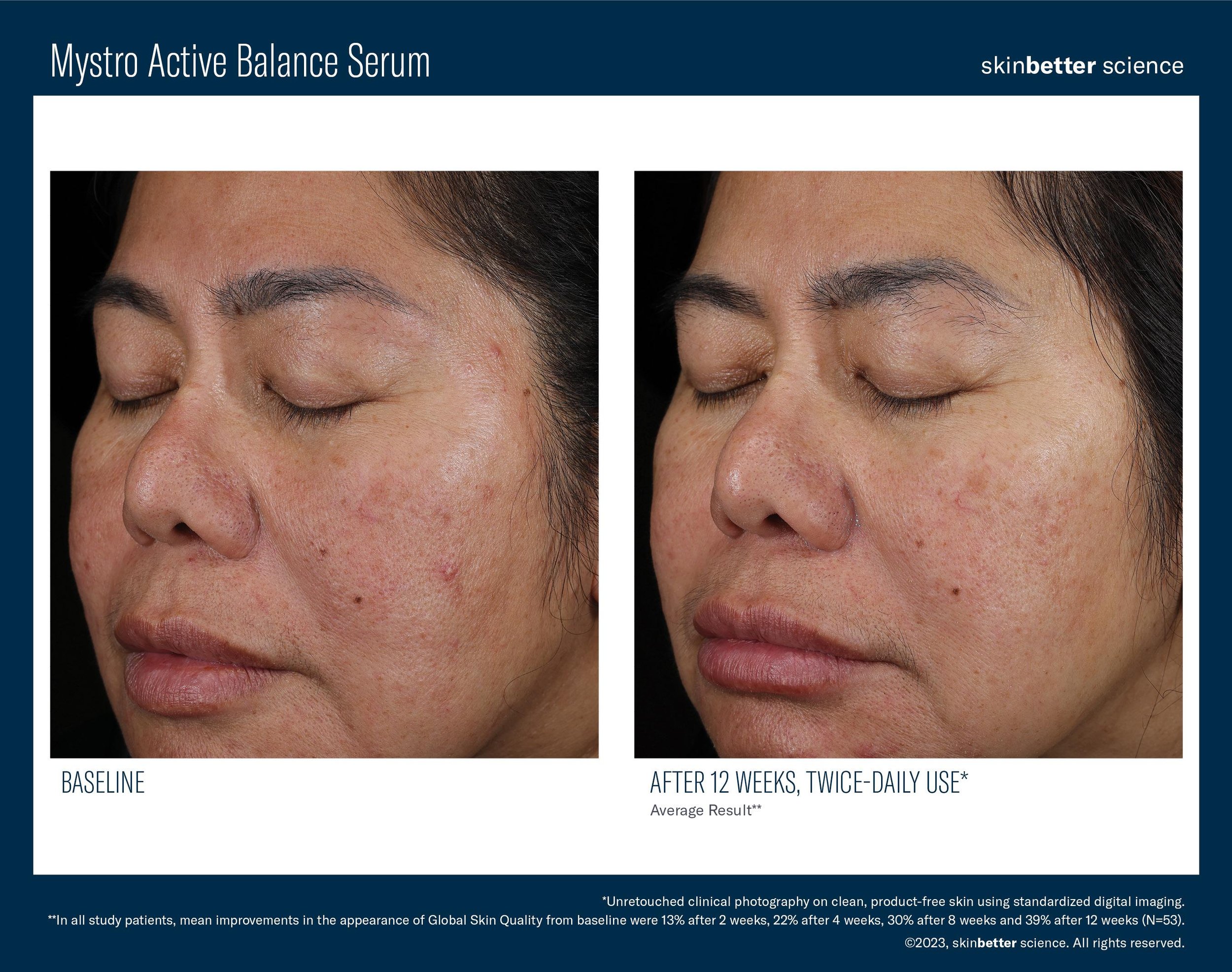 Mystro Active Balance Serum B&A Template9.jpg