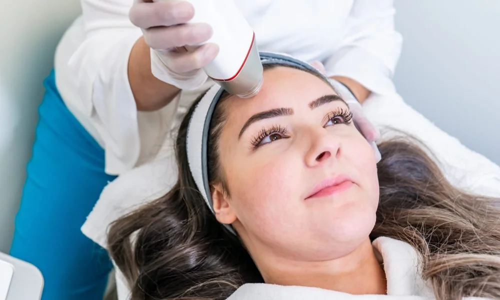 Restoring Youthful and Rejuvenated Skin with Radio Frequency (RF) Microneedling Skin Tightening