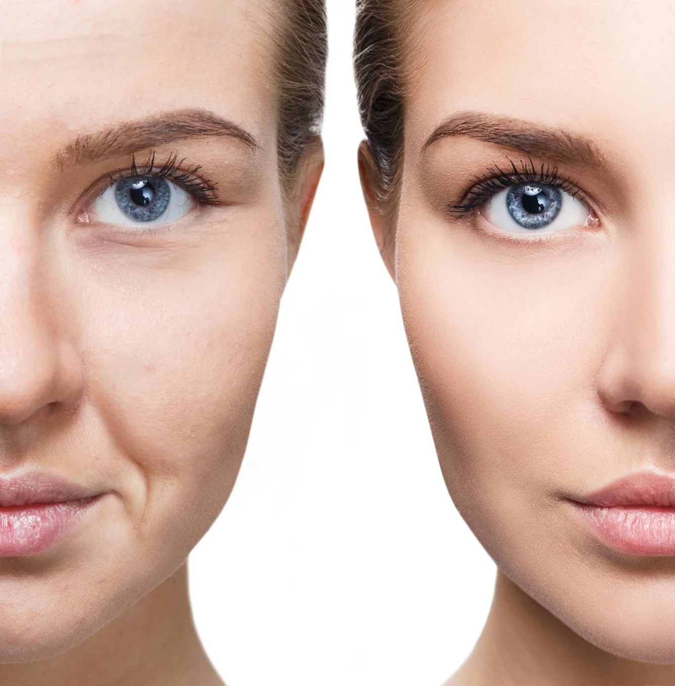 Sculptra Biostimulator at Venustas Immortalis in Dubuque, Iowa