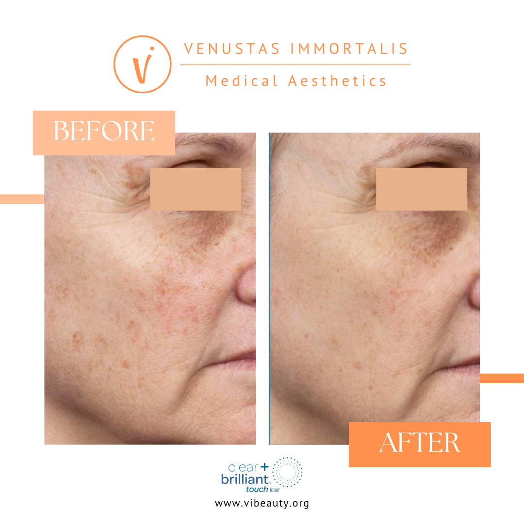 BA Clear & Brilliant (1).png