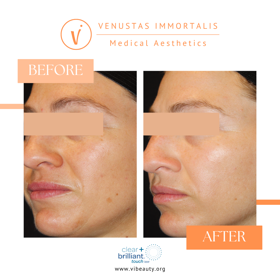 BA Clear & Brilliant.png