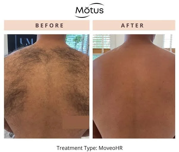 motus9.jpg
