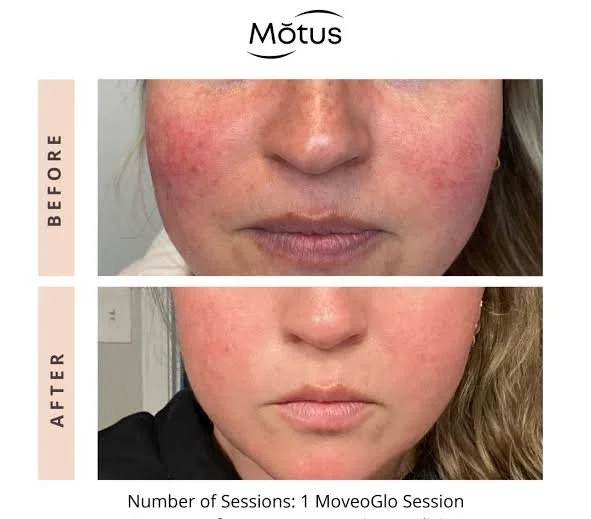 motus8.jpg
