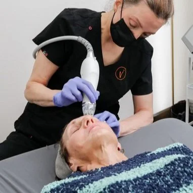 RadioFrequency Microneedling at Venustas Immortalis Med Spa in Dubuque, Iowa