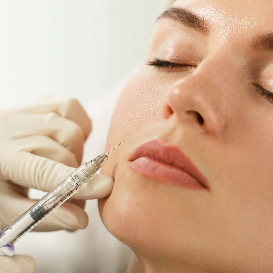 Lip filler treatment at Venustas Immortalis Med Spa in Dubuque, Iowa