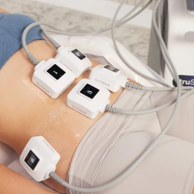 TruSculpt at Venustas Immortalis in Janesville, Wisconsin