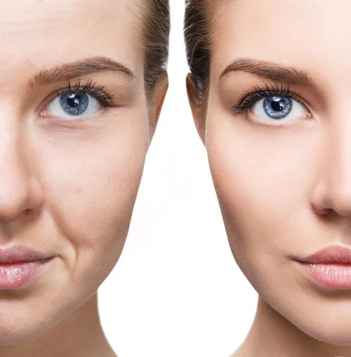 Biostimulator Treatments at Med Spa in Janesville and New Glarus, WI