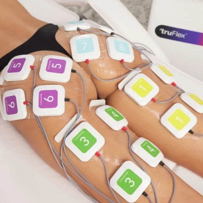 TruFlex Body Contouring at Venustas Immortalis Med Spa in Janesville, Wisconsin