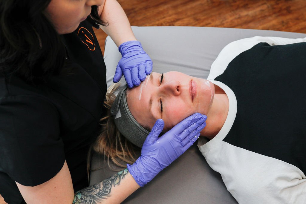 Chemical peel treatment at Venustas Immortalis Med Spa in Janesville, Wisconsin