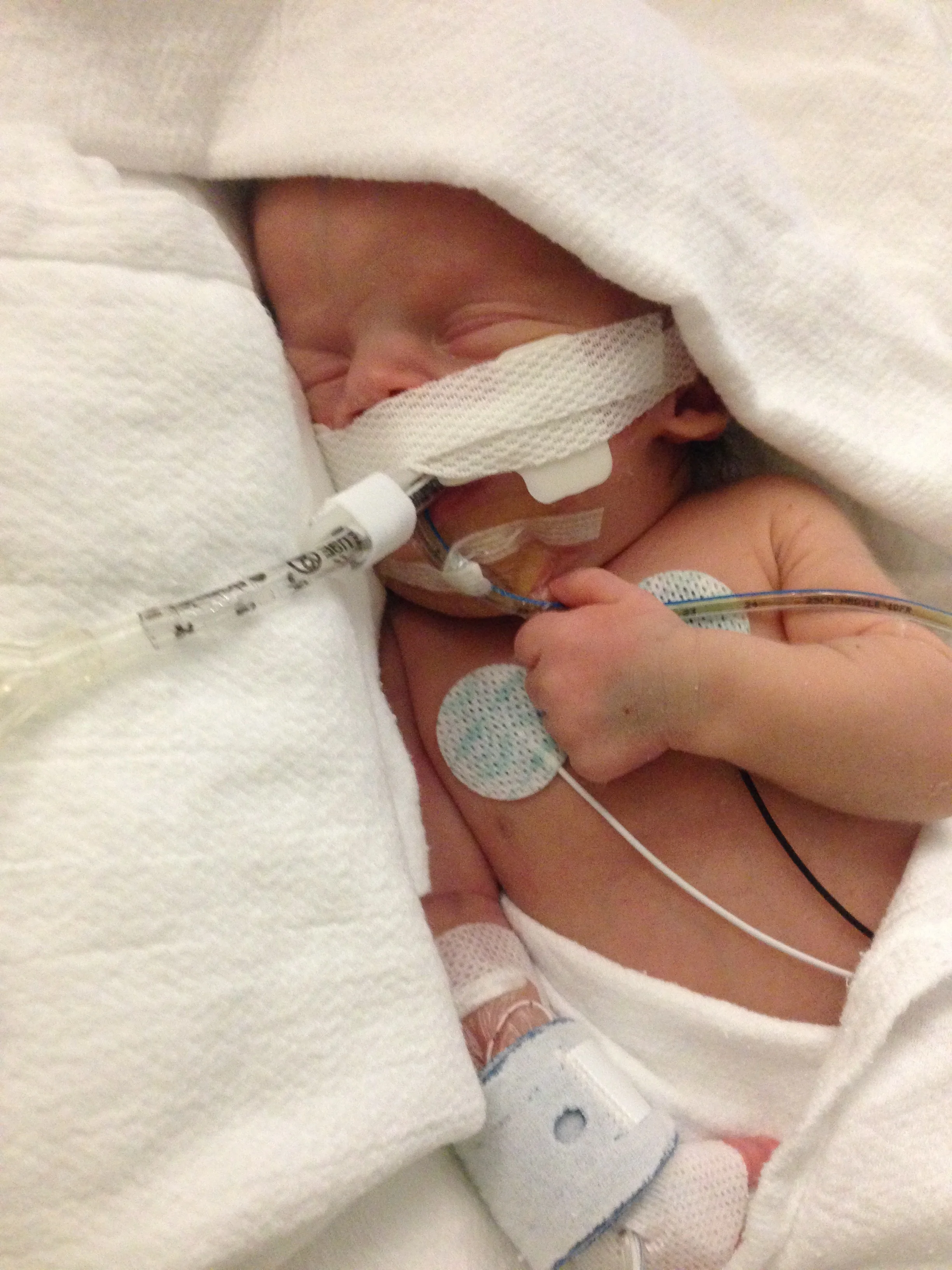NICU Awareness