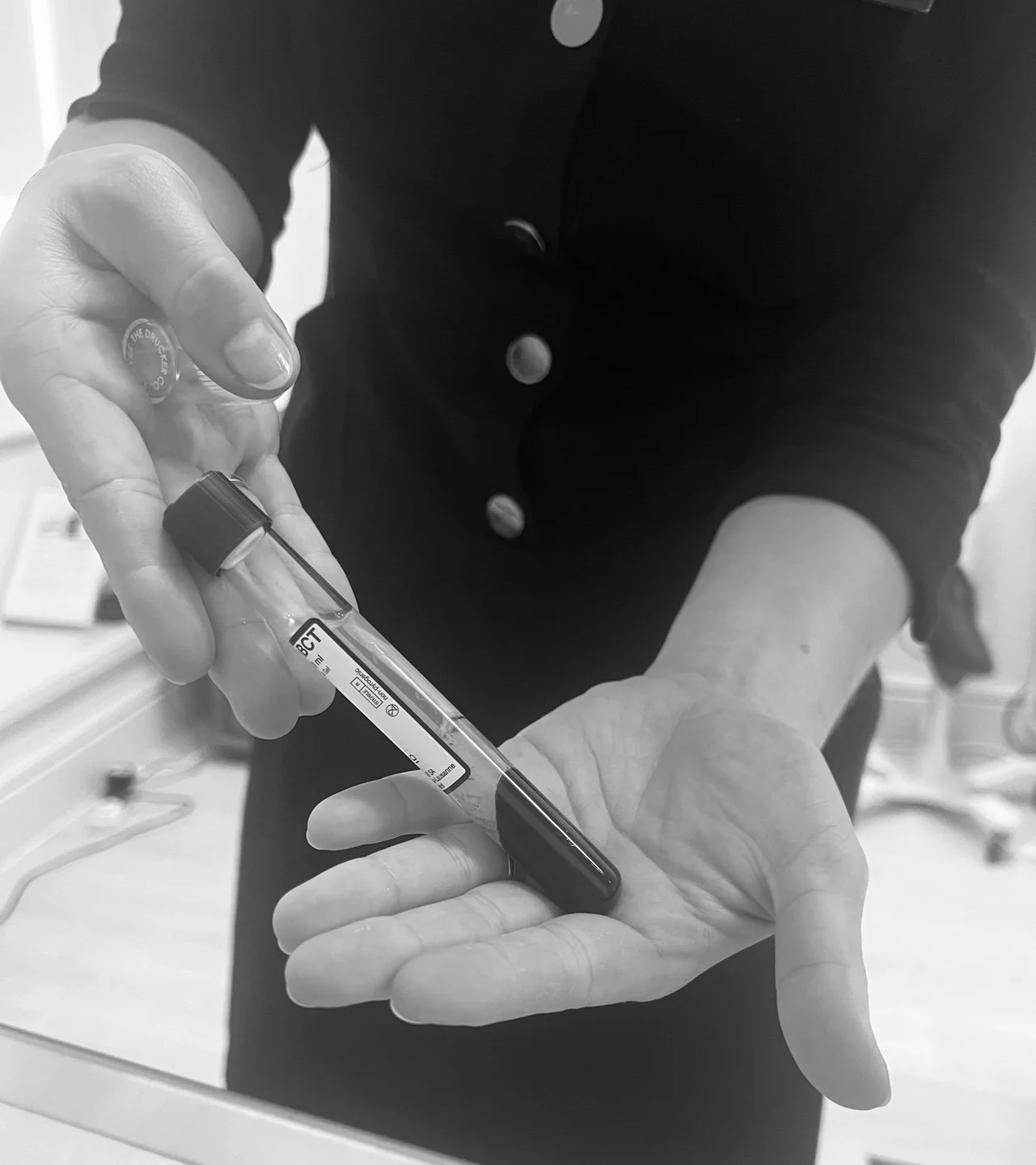 I TRIED PRP &amp; MICRO-NEEDLING AND THIS IS WHAT HAPPENED