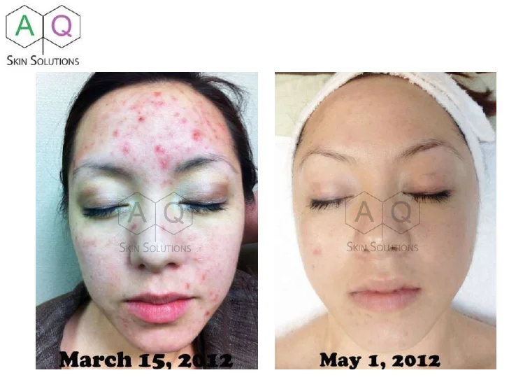 Recovery Serum
