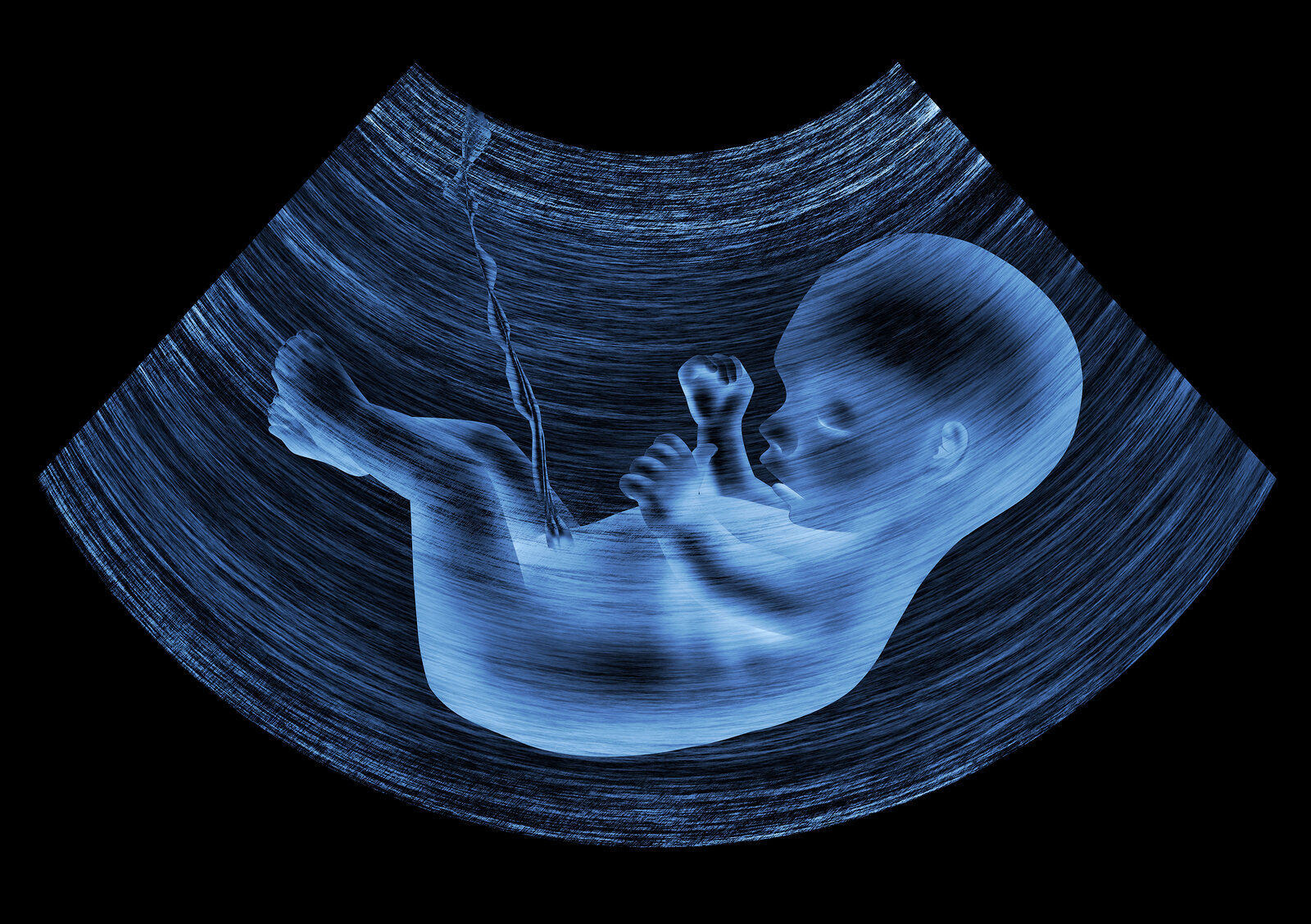 ultrasound treated blue.jpg