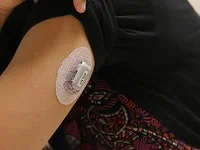 Excuse Me, But What Is That Thing on Your Arm?