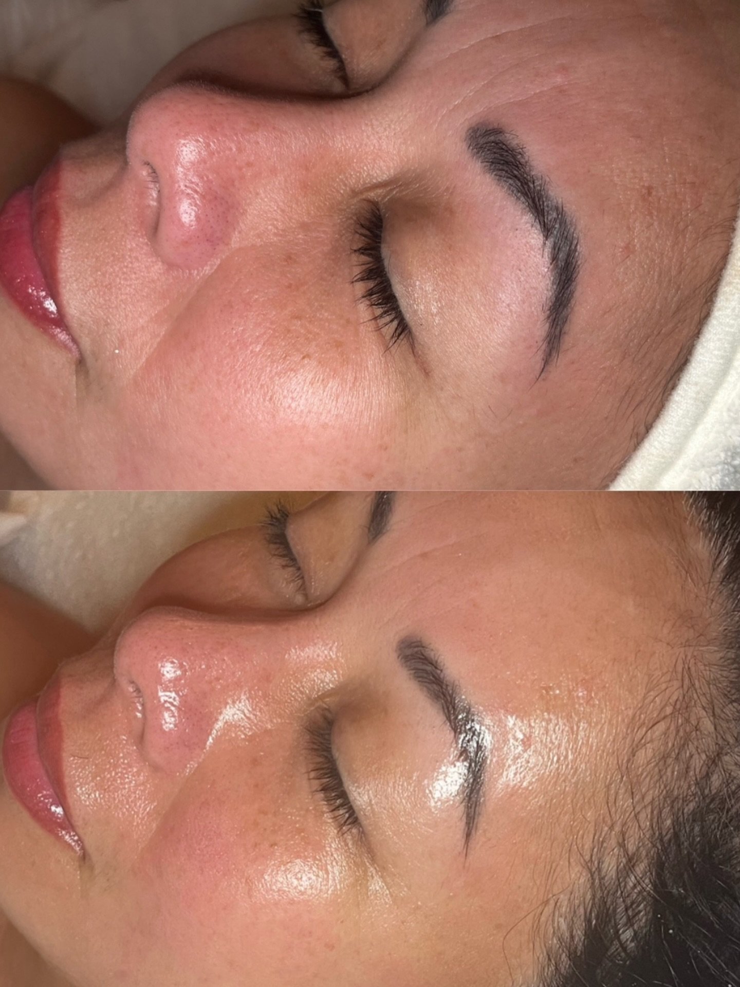 A fully customized VIP Facial | Focused on Skin Health &amp; Longevity

✔ Dermaplaning + gentle enzymes to remove dead skin buildup
✔ Ultrasound infusion of growth factors &amp; stem cells for deeper absorption
✔ LED light therapy to boost cellular e