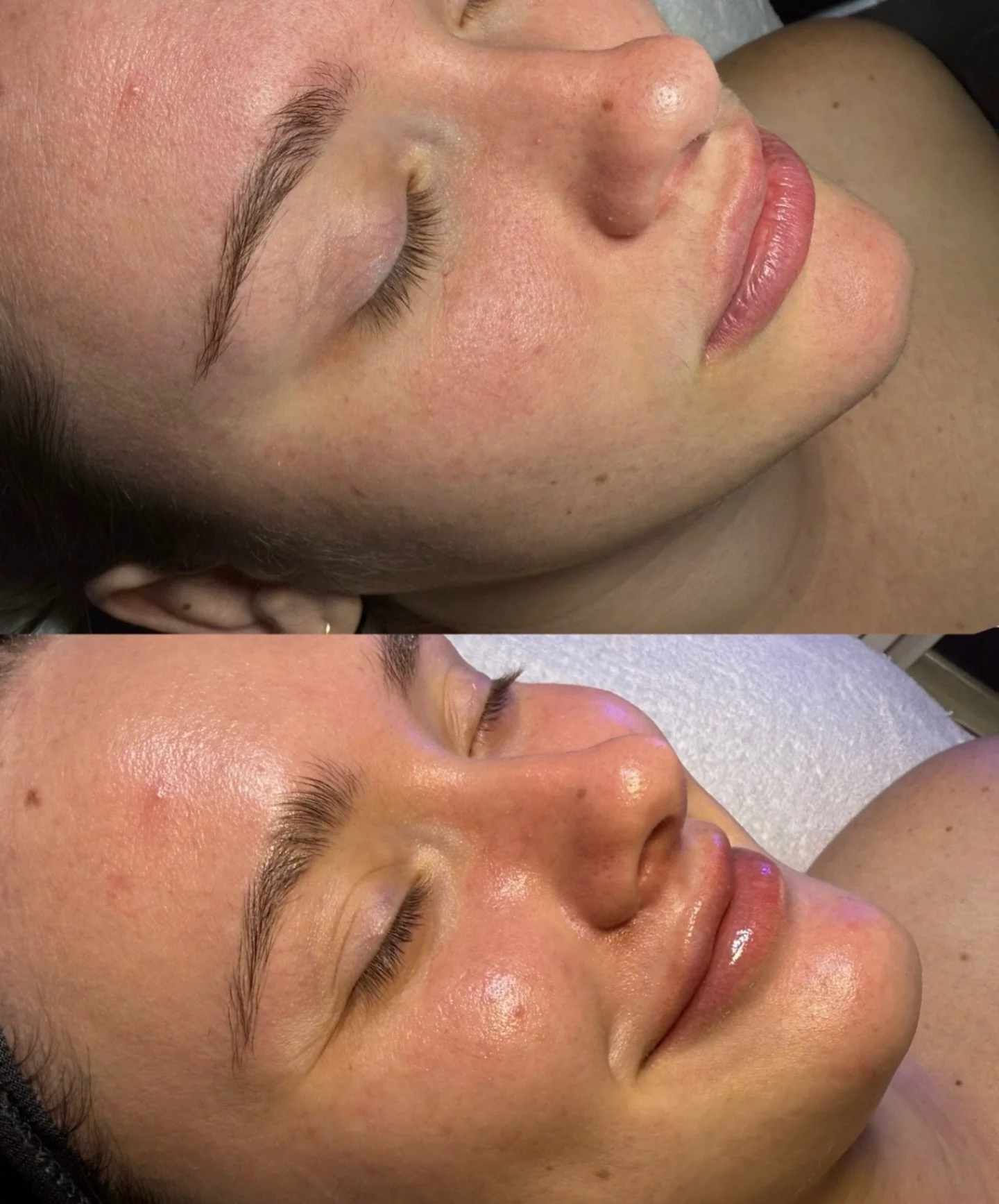 Turns out, glowing skin is the best mood booster. 😍 All she needed was a HydraFacial to bring out that smile (and that glass-skin glow!). #hydrafaci̇al 

$25 OFF your first HydraFacial with us! 💦 

Let's get you glowing! 
💻 Easy Online Booking
📞 