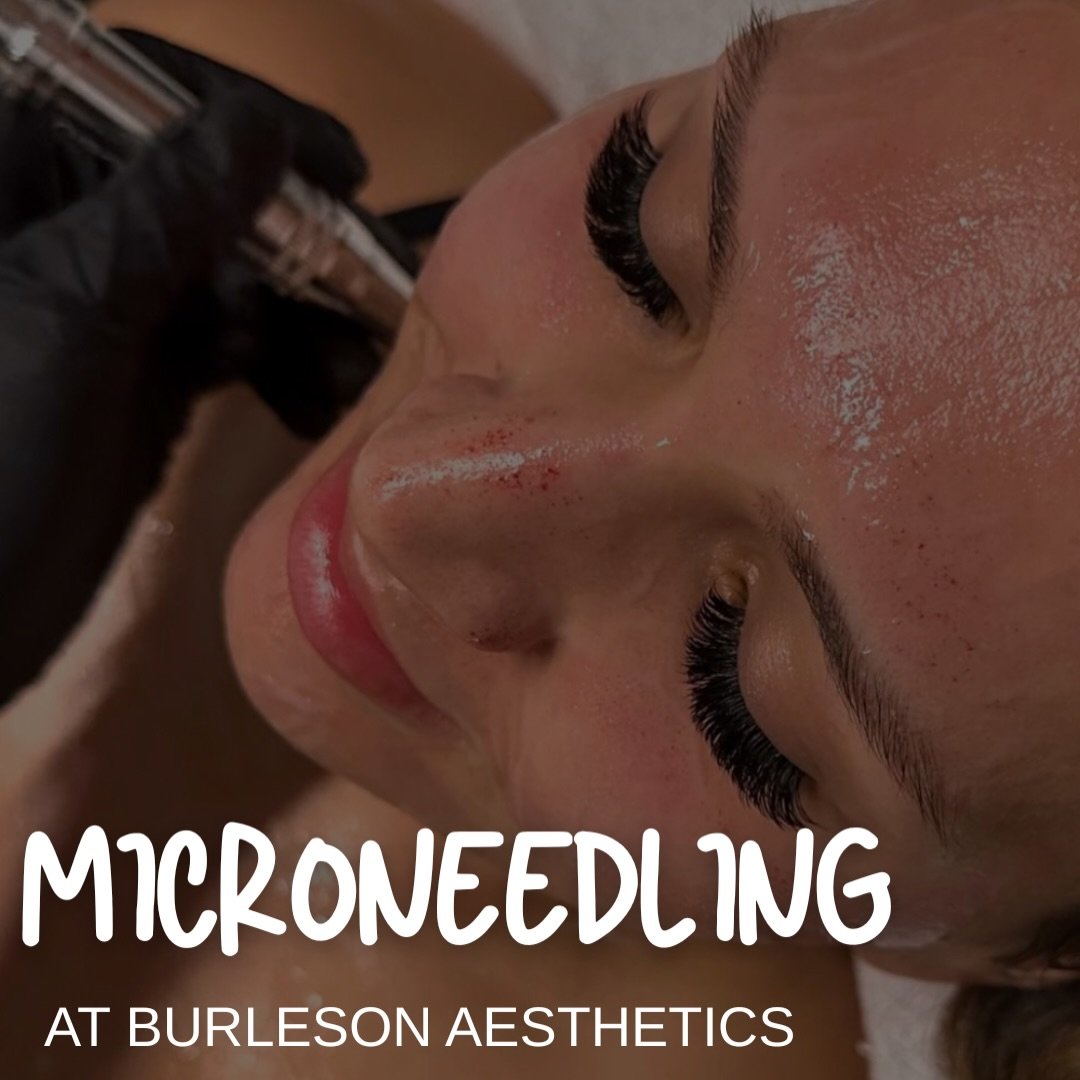 Stay ahead of premature aging.

As collagen naturally declines over time, preventative treatments become one of the best investments you can make for long-term skin health.

Microneedling helps support collagen production beneath the surface while im