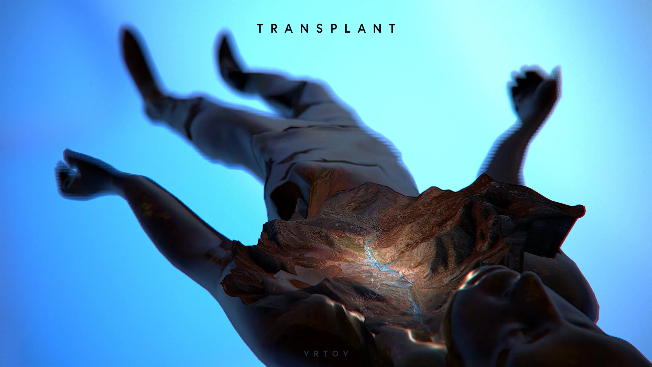 Transplant
