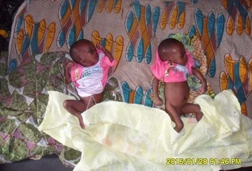 twins-from-village-at-1-month-e1462526797213.jpg